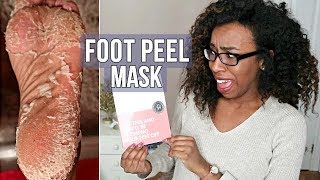 Foot Peel Mask CRAZY RESULTS [upl. by Terrill985]