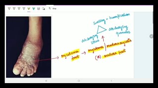 Subcutaneous Deep Mycoses  Microbiology  Image based discussion [upl. by Swithin]