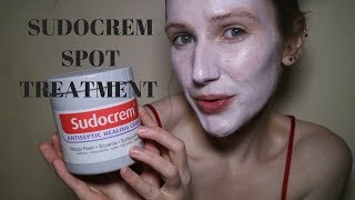 Get rid of spots acne and blemishes FAST Sudocrem Face Mask [upl. by Pass986]