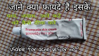 Framycetin Skin Cream hindi review  घाव जखम  जले कटे को ठीक करे ।। जाने कैसे use करे [upl. by Athiste]