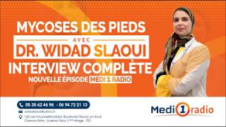 La mycose des pieds Dr Widad SLAOUI [upl. by Silden]