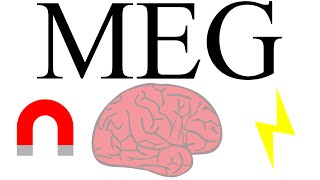 Magnetoencephalography measuring brain activity with magnetism [upl. by Airyt559]