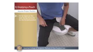 ColostomyIleostomy Emptying a Pouch [upl. by Hanas]