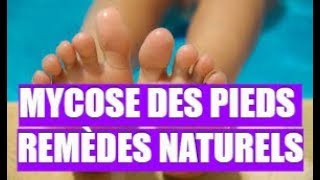 👉 MYCOSE DES PIEDS ★★★★★ REMÈDES NATURELS [upl. by Arahsak]