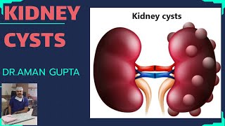 Symptoms of Kidney Stone  Dr Nicholas Laryngakis [upl. by Grose475]