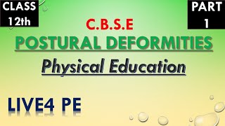 Postural Deformities  Class 12  Physical Education LIVE4PE [upl. by Aminta]