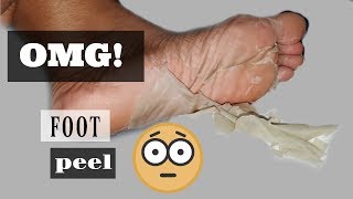 First Time Trying A Natural Foot Peel  Earth Therapeutics Foot Peel Review [upl. by Cos]