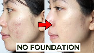 How to Cover Acne amp Blemishes WITHOUT Foundation • easy amp non cakey [upl. by Nancie]