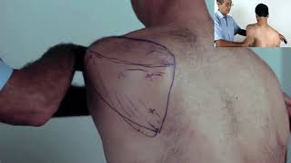 Trigger Point Master Class  How to Release Infraspinatus [upl. by Obrien117]