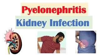 Symptoms of Kidney Stones  Dr Anantharaman Ramakrishnan [upl. by Sorac]