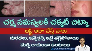 How to Get Relief from Itching  Parasitic Infection  Albendazole Tablets  DrRavikanth Kongara [upl. by Cesar825]