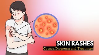 Skin Rash Causes Signs and Symptoms Diagnosis and Treatment [upl. by Benjamin]