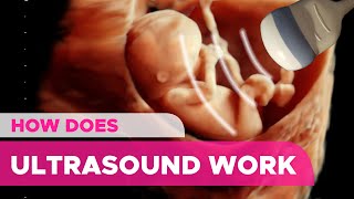 How Does an Ultrasound Works [upl. by Normak]