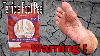 Warning ⚠️ Don’t buy  Foot Peel Gone Wrong [upl. by Caasi]