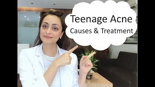 Teenage Acne causes amp treatment [upl. by Ayouqat922]